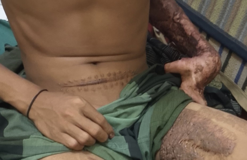 Dua Tahun Terkubur, Dugaan Rekayasa Kronologi Kecelakaan Kerja Di PT Thaka Sukses Mandiri Dibongkar: Keluarga Korban Tuntun Keadilan !